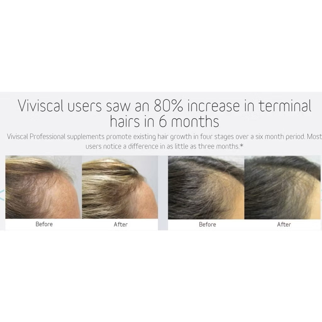 ☘️180 tablets Exp 06/2027 VIVISCAL PRO Professional Hair Growth (UNISEX) -MADE IN USA